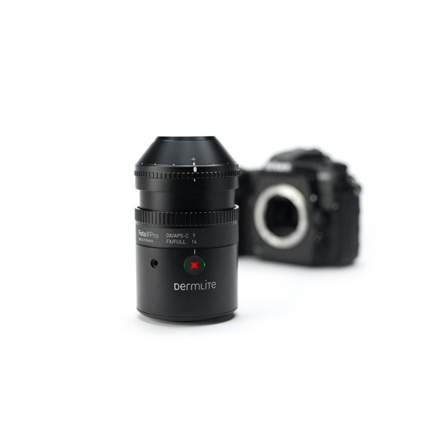Dermlite FOTO II Pro Dermoscopy Kit includes Lens, Charger and Mounts for Canon and Nikon