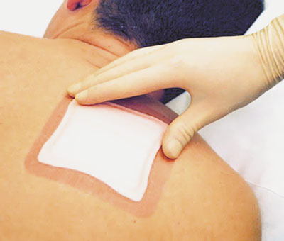 Allevyn Adhesive Border Foam Dressing 12.5cm x 12.5cm. Box of 10 