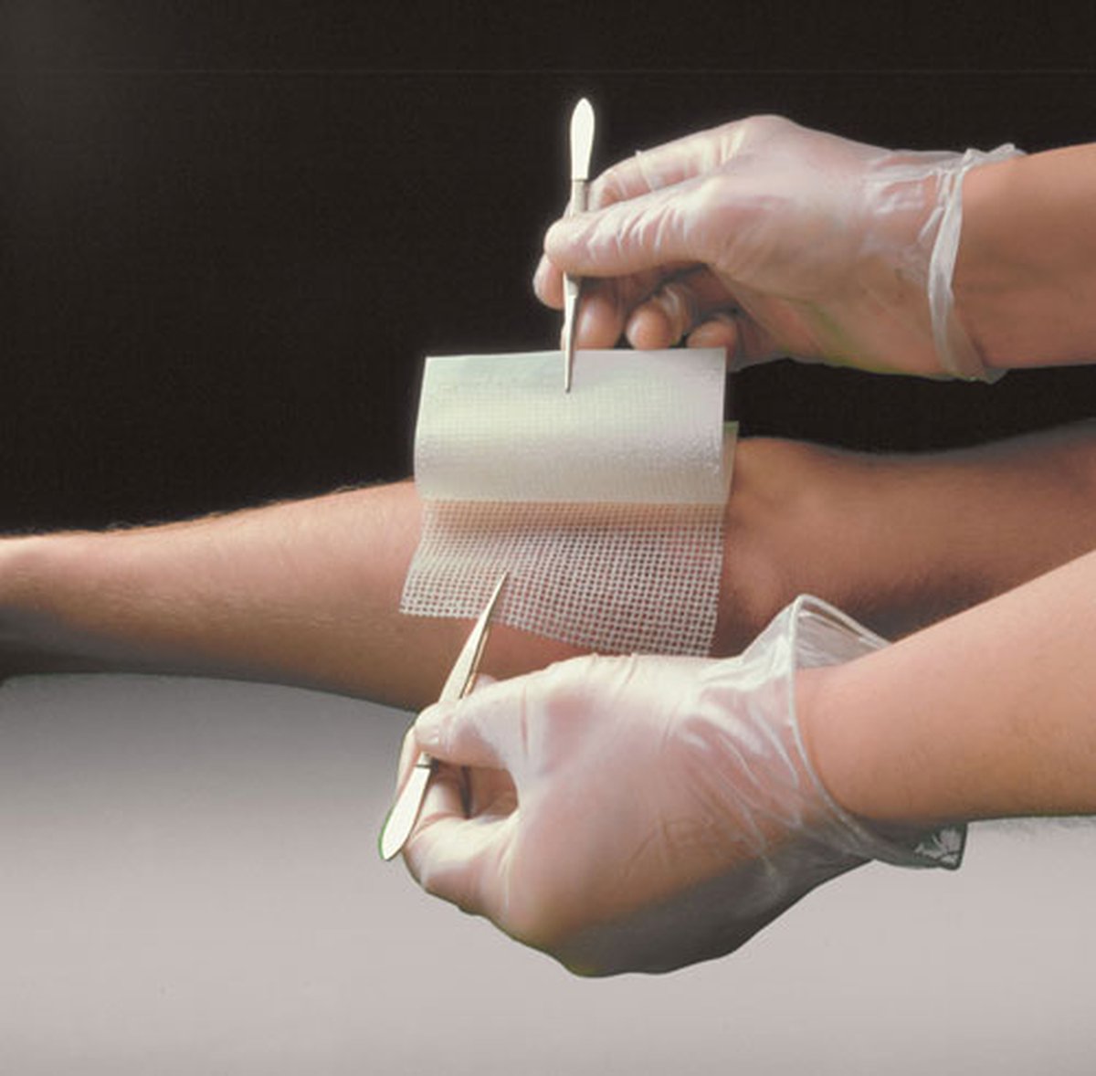 Bactigras Medicated Paraffin Gauze Dressing 10cm x 10cm. Box of 50