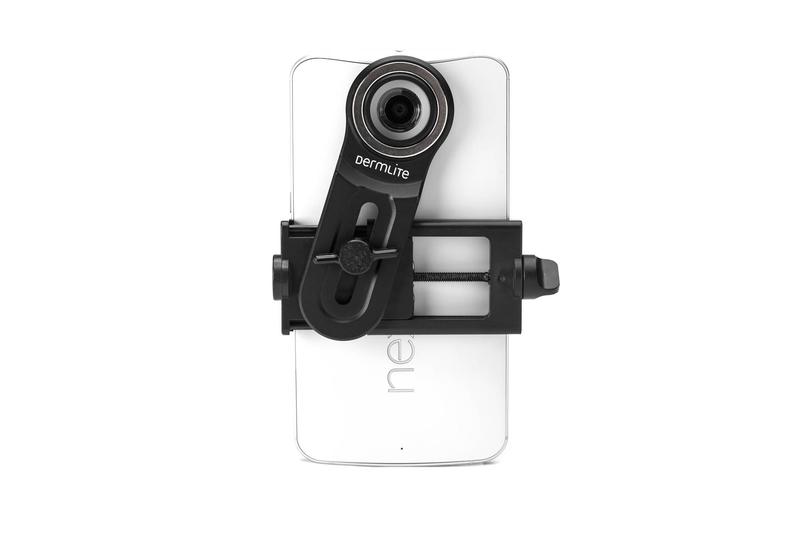 DermLite Universal Smartphone Adaptor with Magnetic Connector Ring
