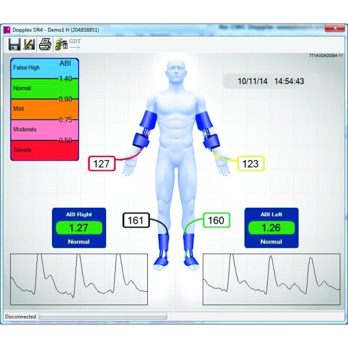 Huntleigh Dopplex ABIlity eABI Doppler- PC Based Unit