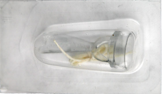 Plastibell Circumcision Device 1.5cm Sterile. Pack of One