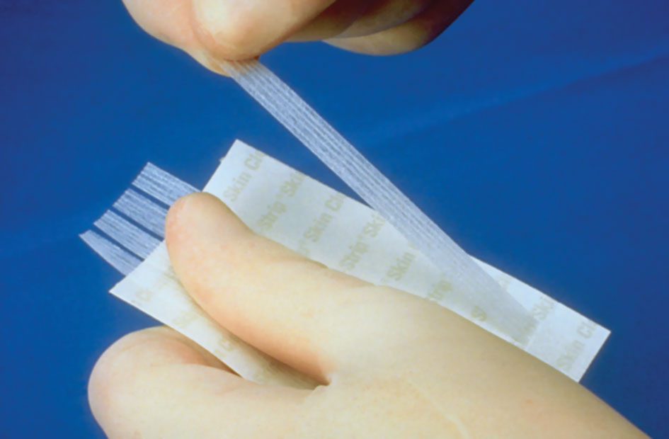 Steri-Strip Reinforced 25mm x 125mm. 25 Packets of 4 - Yellow Pack