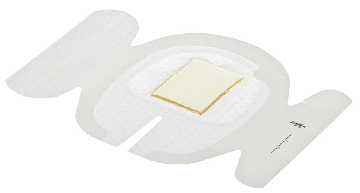 Tegaderm CHG IV Securement Dressing 8.5cm x 11.5cm. Box of 25