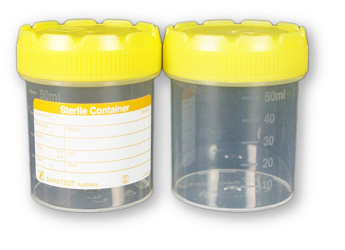 Urine Specimen Container Labelled 70ml Sterile, Yellow Cap. PACK OF 100